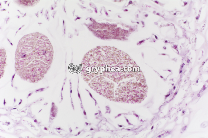 Fucus dioïque - conceptacle femelle x100 - gryphea.com